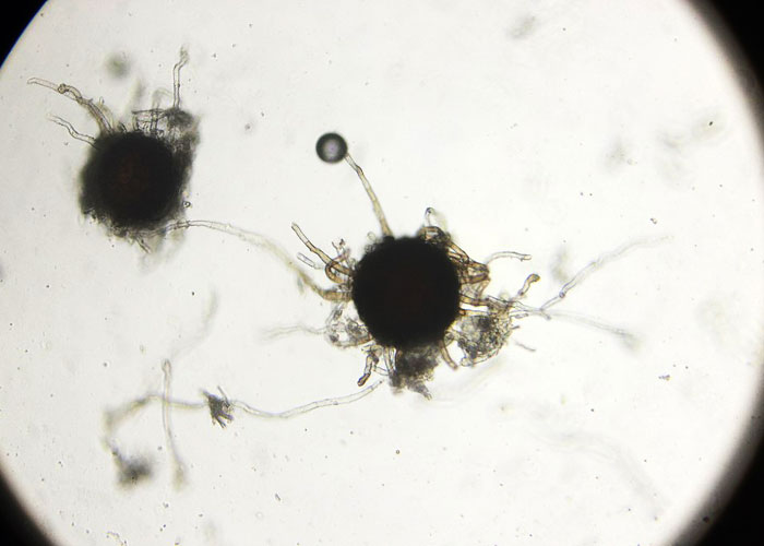 downy mildew fungus under a microscope